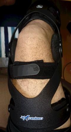 退院直後に膝を保護するために使用していた黒い膝装具を装着した右足の写真。