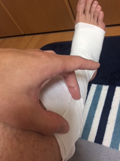 包帯の継ぎ目の例1