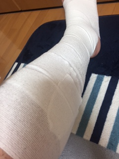 包帯の継ぎ目の例2