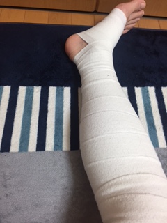 足の裏から太ももまで包帯を巻いた様子2