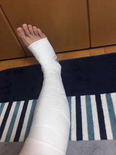 足の裏から太ももまで包帯を巻いた様子1
