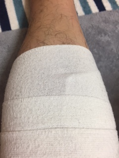 ふくらはぎからの包帯の巻き始め