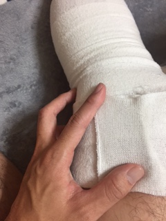 ふくらはぎから太ももまで巻いたときの継ぎ目