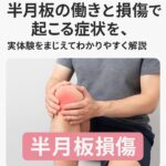半月板の働きと損傷で起こる症状を、実体験をまじえてわかりやすく解説